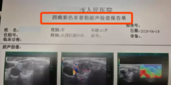一份“四维彩超报告”引发的思考