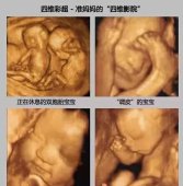 四维彩超那么贵，做完看不懂？3分钟教你