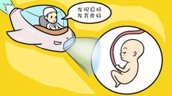四维彩超要做多长时间