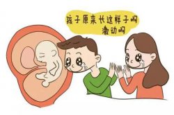 四维彩超对胎儿有影响吗