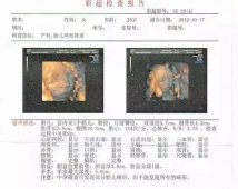 四维彩超那么贵，做完看不懂？