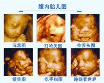 四维彩超宝宝大手大脚正常吗