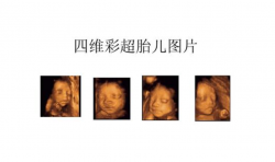 厦门哪里正规医院做四维彩超