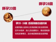 怀孕后身体有什么变化放松心情，必要时