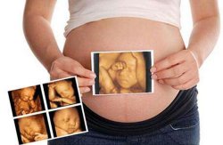 <b>孕妈四维彩超最佳的检查时间</b>