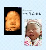 <b>孕妇厦门做四维彩超要多少钱</b>