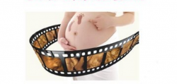 <b>四维彩超孕妇最佳黄金检查时间</b>