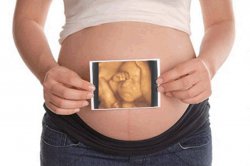 <b>孕妇做四维彩超前可以吃早餐吗——厦门</b>