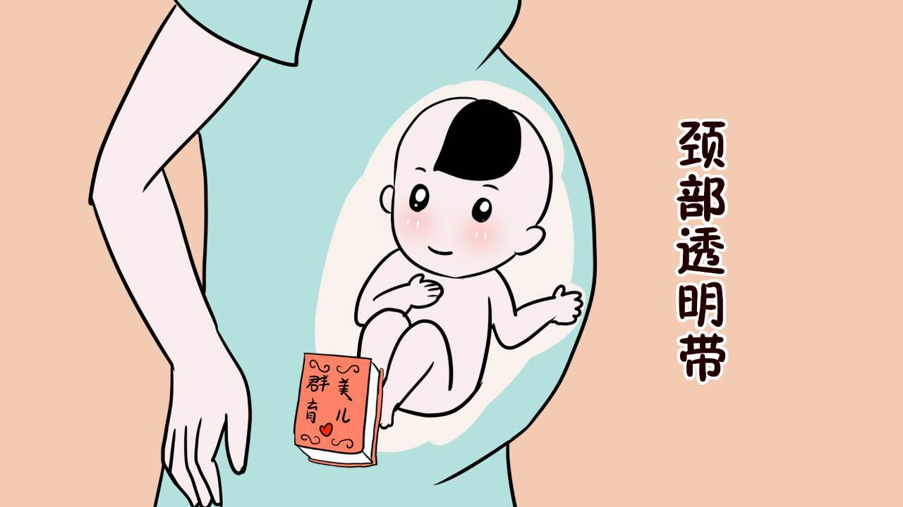 医院做NT检查多少钱