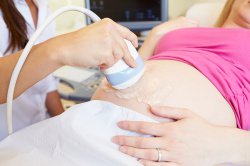 <b>准妈妈做四维彩超多少次合适呢</b>