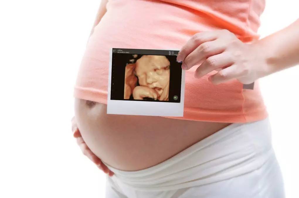 孕妈妈什么时候适合做四维彩超