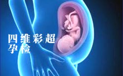 <b>四维彩超的强大优势</b>